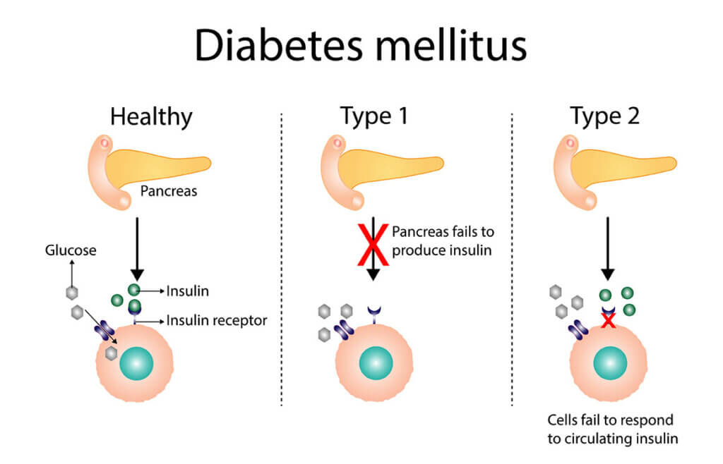 diabetes